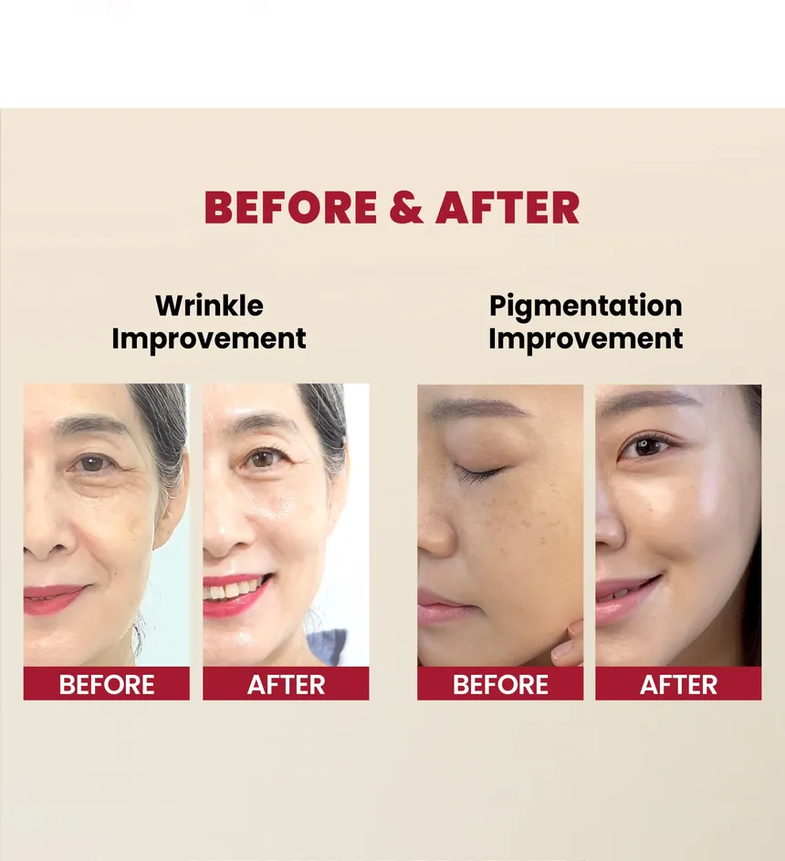 KSECRET - SEOUL 1988 Serum : Retinal Liposome 2% + Black Ginseng