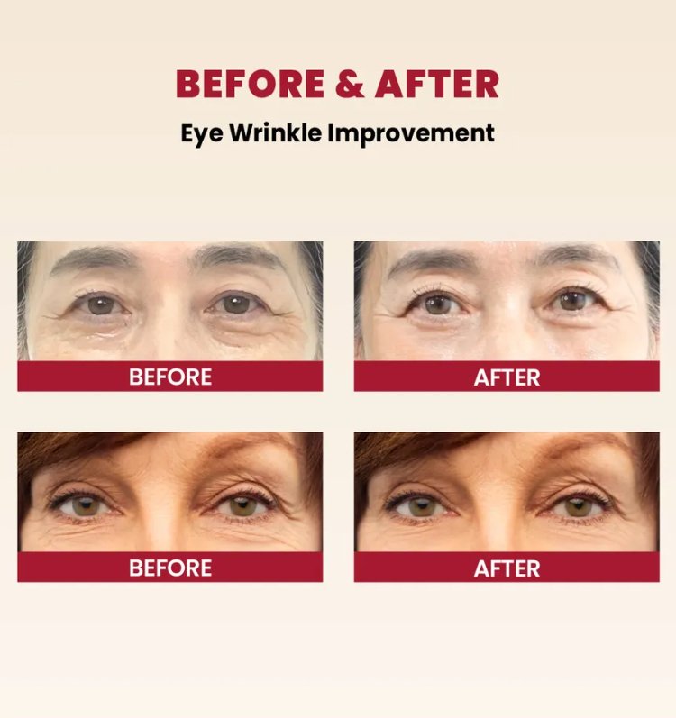 KSECRET - SEOUL 1988 Eye Cream : Retinal Liposome 4% + Fermented Bean