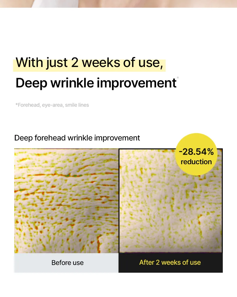 celimax - The Vita-A Retinal Shot Tightening Booster