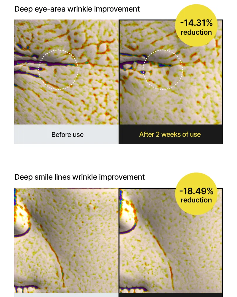 celimax - The Vita-A Retinal Shot Tightening Booster
